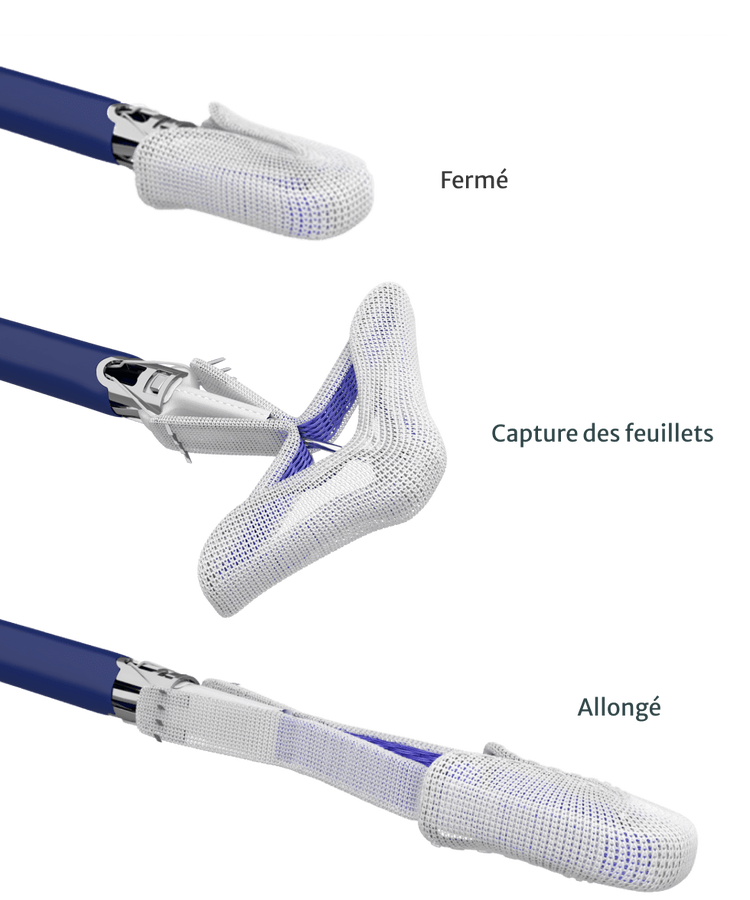 Pascal Edardws The PASCAL Precision system | Edwards Lifesciences