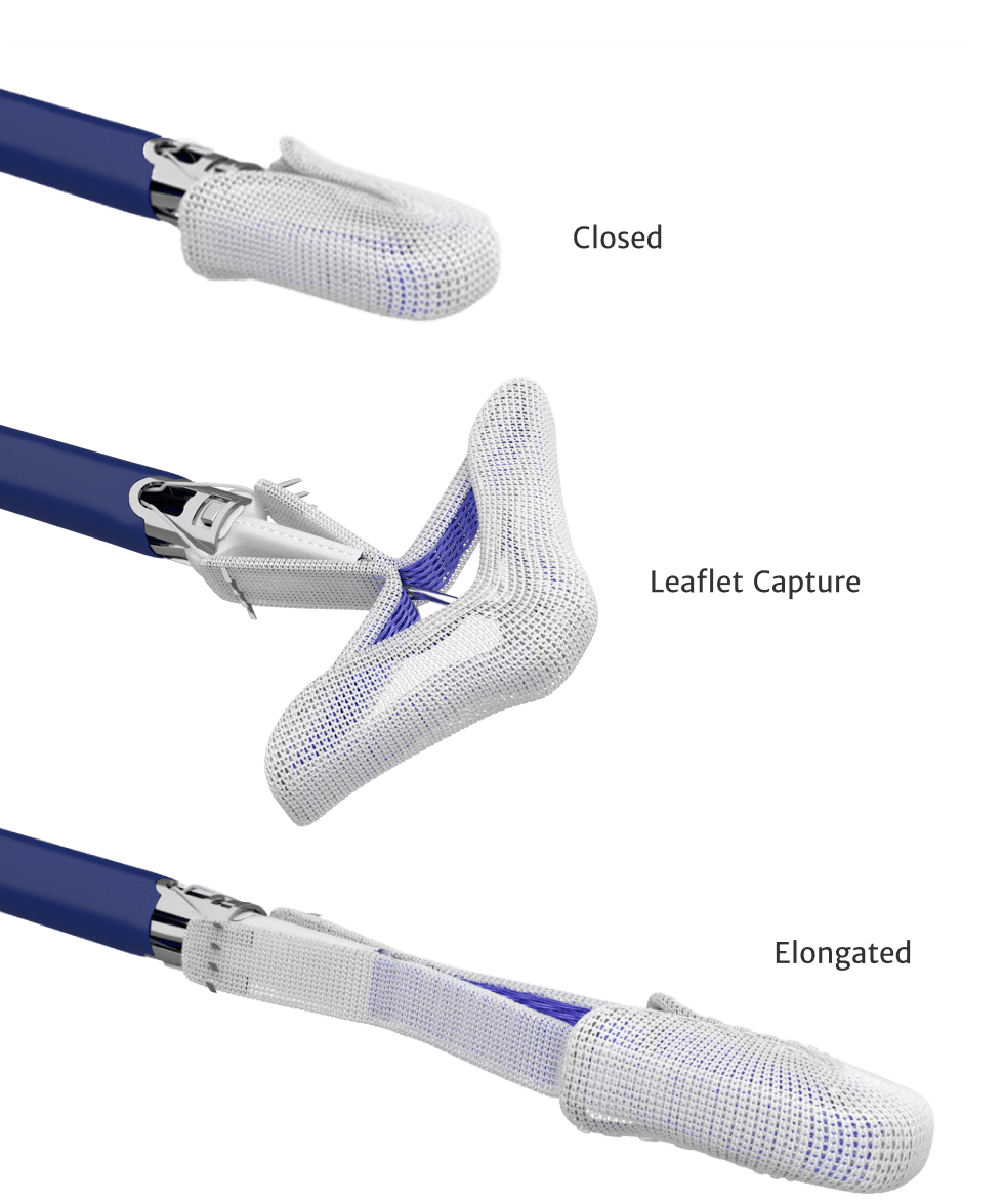 The PASCAL Precision system | Edwards Lifesciences