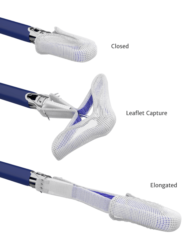 The PASCAL Precision system | Edwards Lifesciences