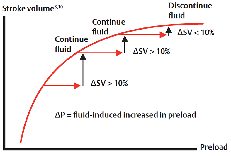 Stoke volume - preload graph Image