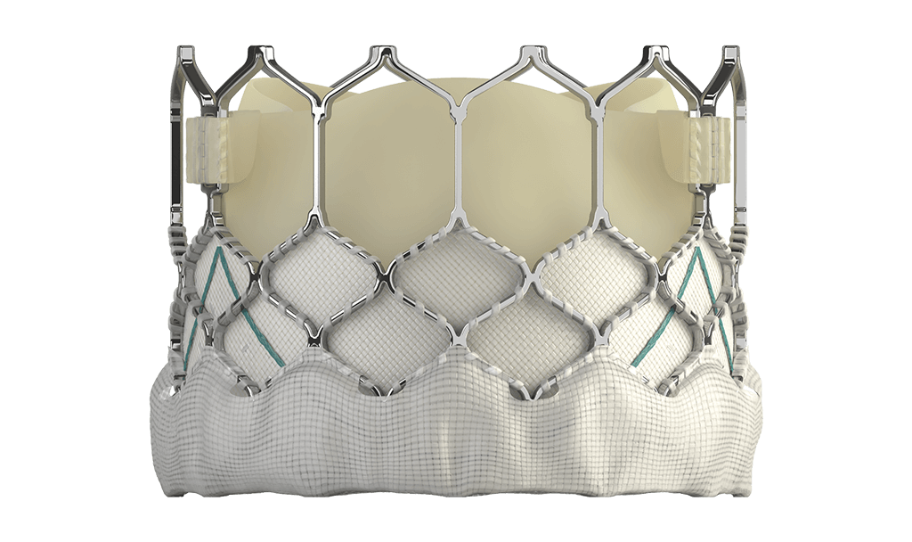 SAPIEN 3 valve - side view