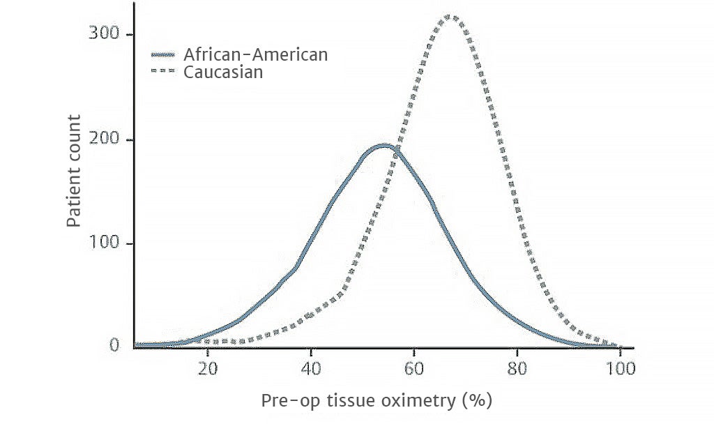 preoperative tissue oximetry