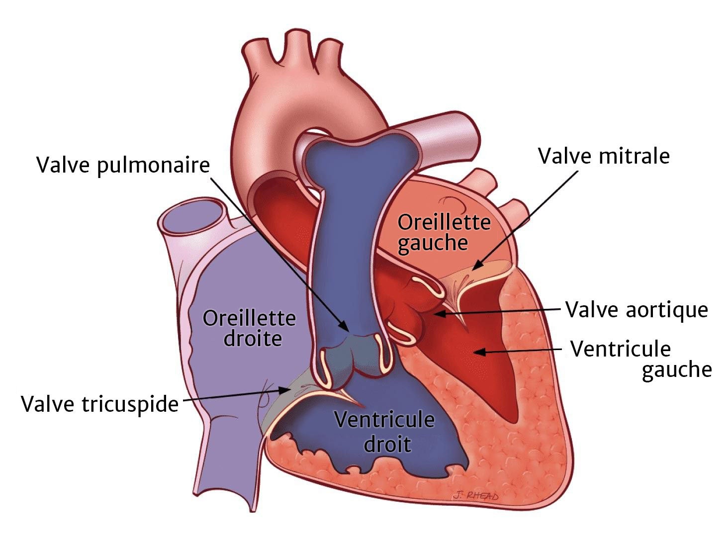 Illustration Anatomique De La Sténose De La Valve Pulmonaire
