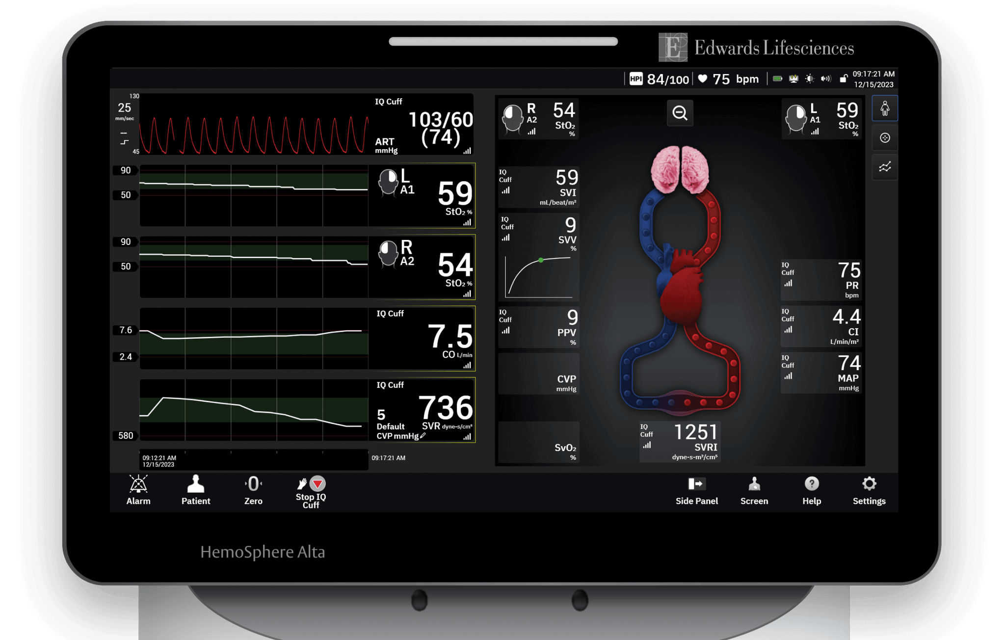 HemoSphere Alta monitor | Edwards Lifesciences