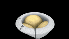 RESILIA tissue product 3