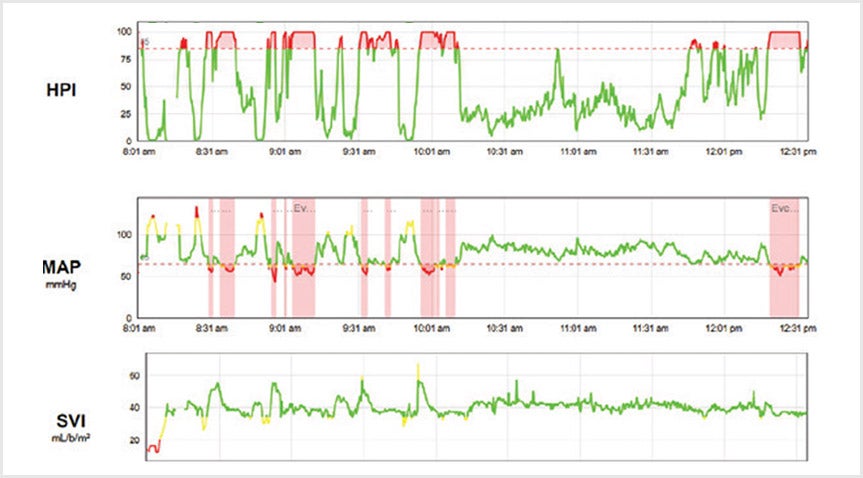 Trend parameters image