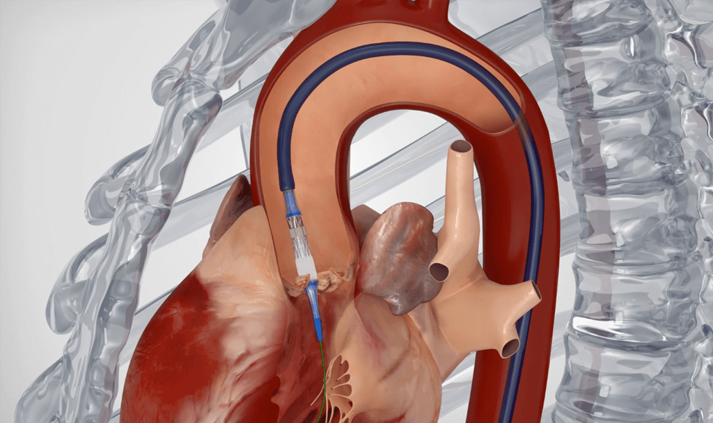 SAPIEN 3 Ultra Procedural Animation