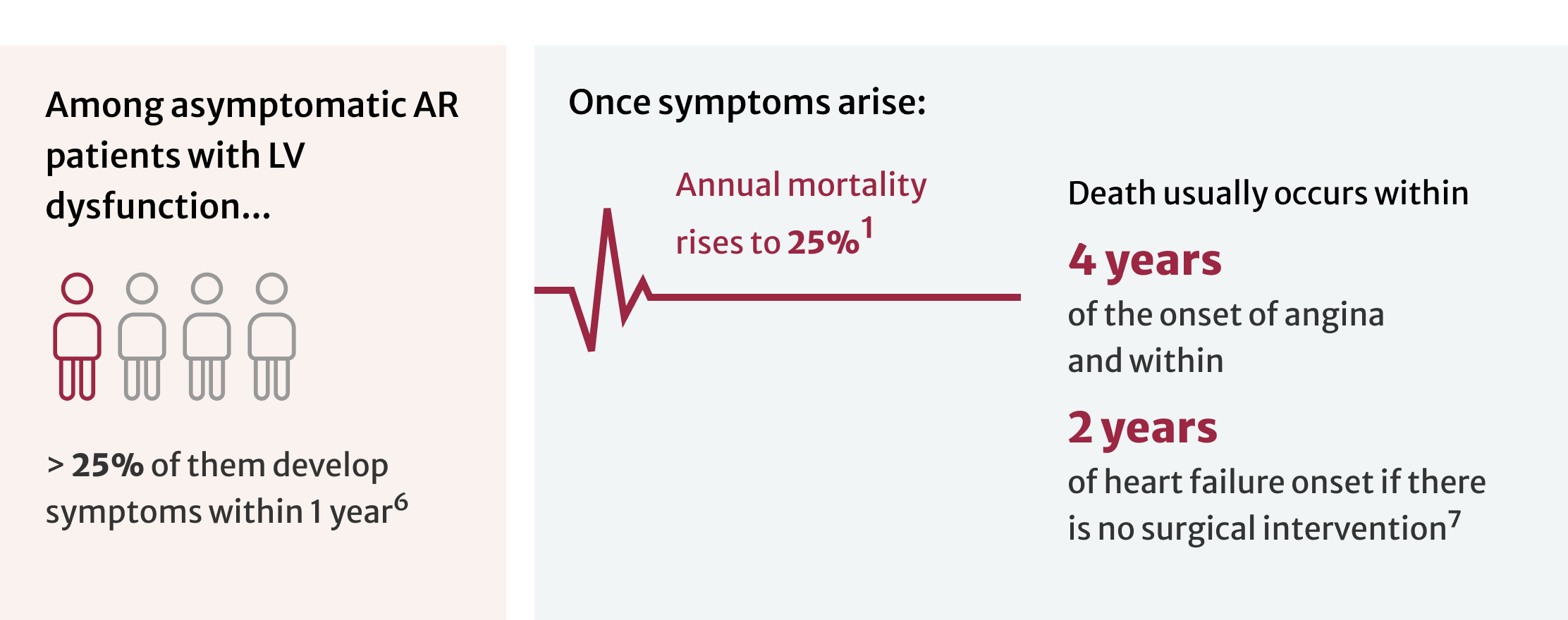 Aortic Regurgitation Edwards Lifesciences