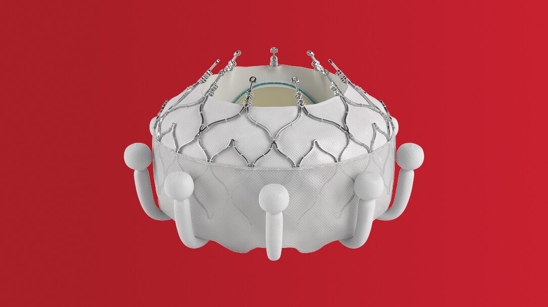 The EVOQUE System thumbnail