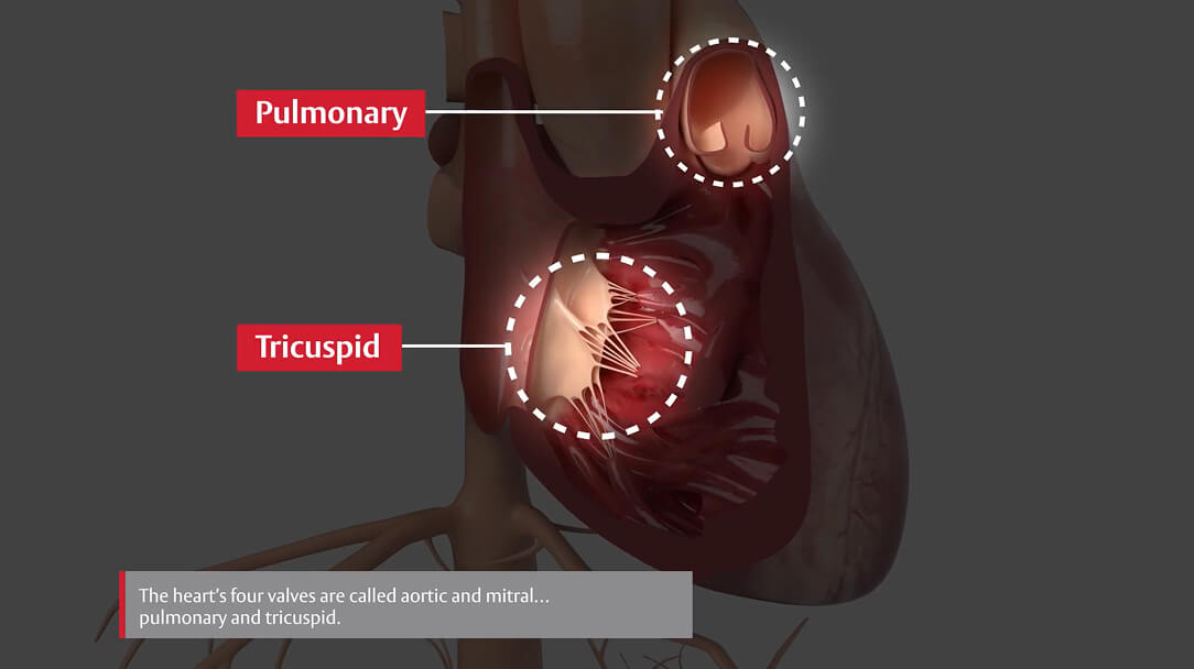 What is tricuspid regurgitation
