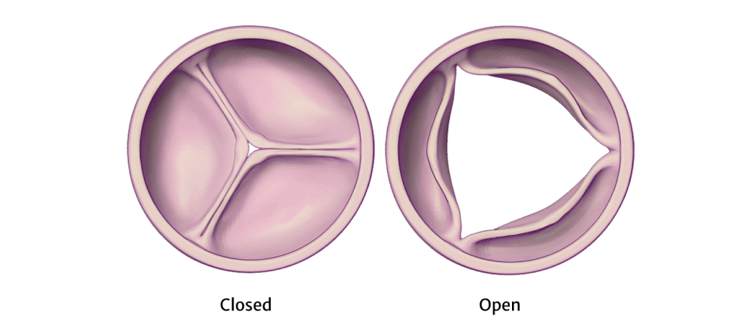Healthy Aortic Valve