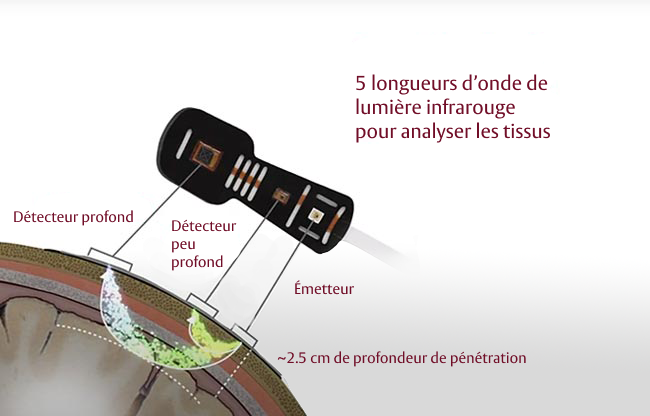 Designed for patient diversity 