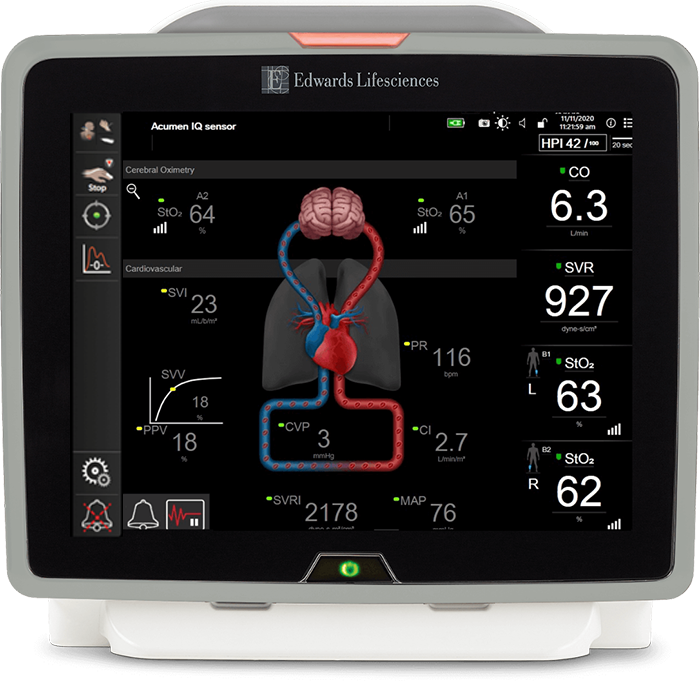 Foresight O2 Sensor ForeSight tissue oximetry sensor | Edwards Lifesciences