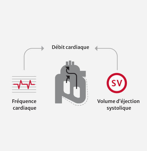 Cardiac Output diagram