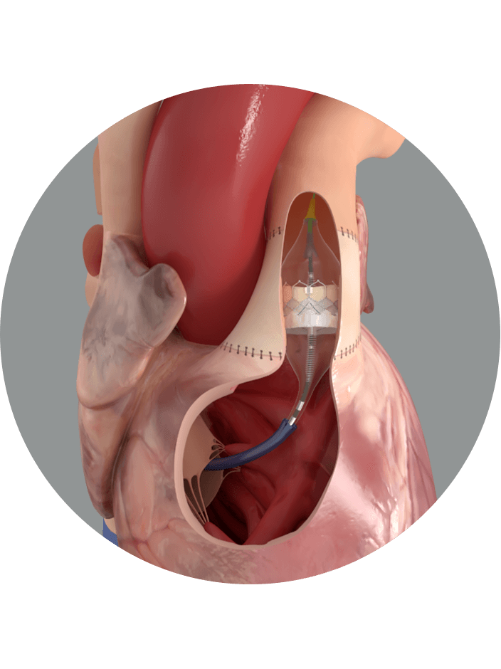  sapien-3-performance