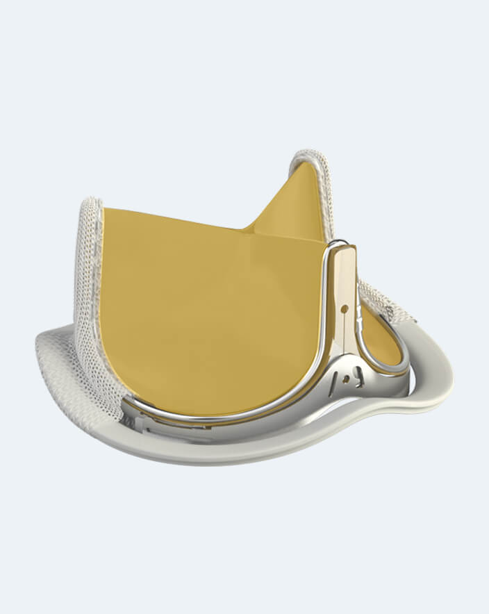 Magna ease