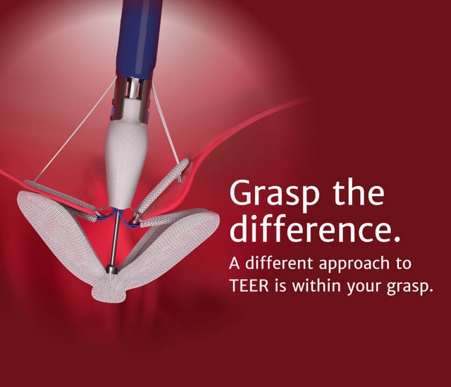 The PASCAL Precision system | Edwards Lifesciences