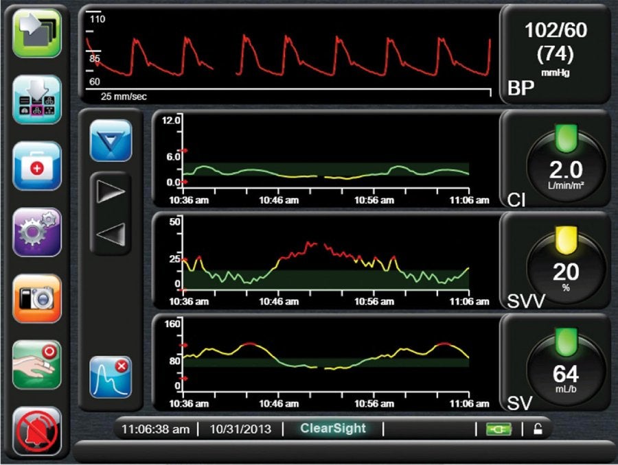 Graphical Trend screen