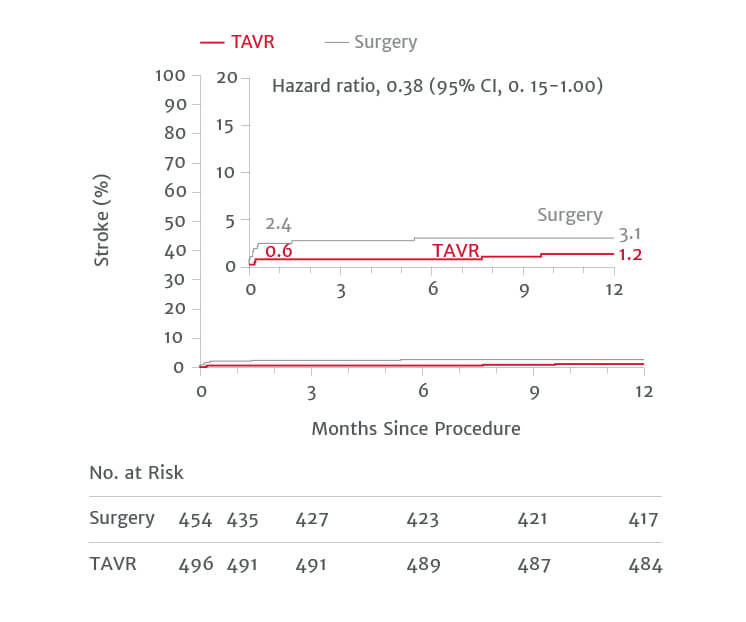 stroke chart