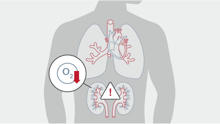 kidney low oxygen