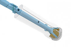 konect avc back angle