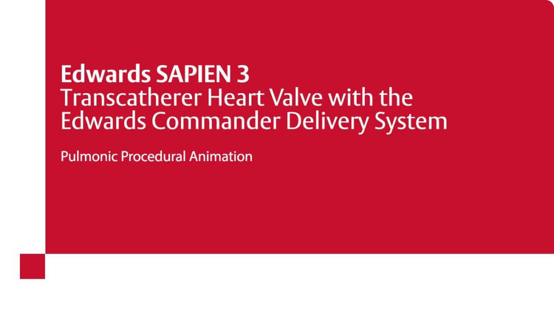 Transcatheter pulmonary valve replacement Edwards Lifesciences