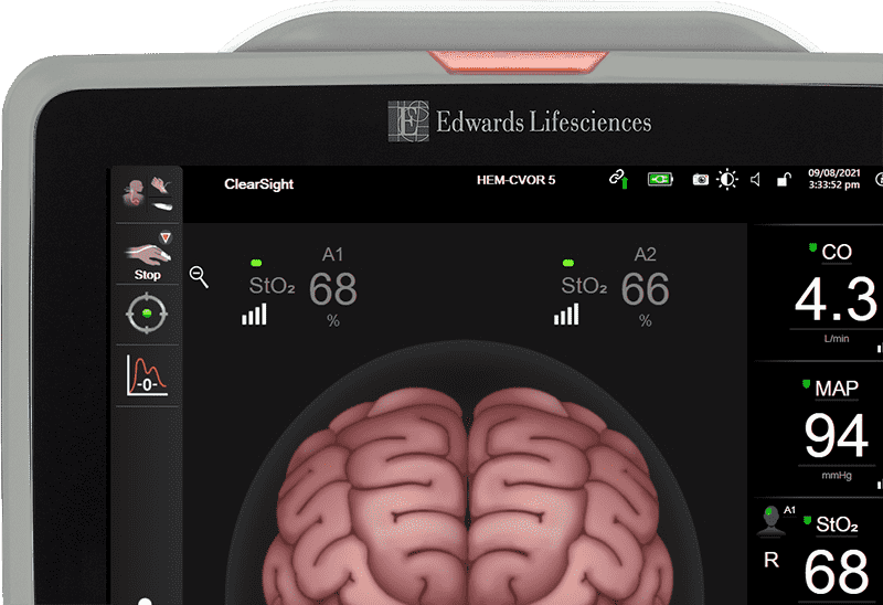 HemoSphere advanced monitoring platform - image