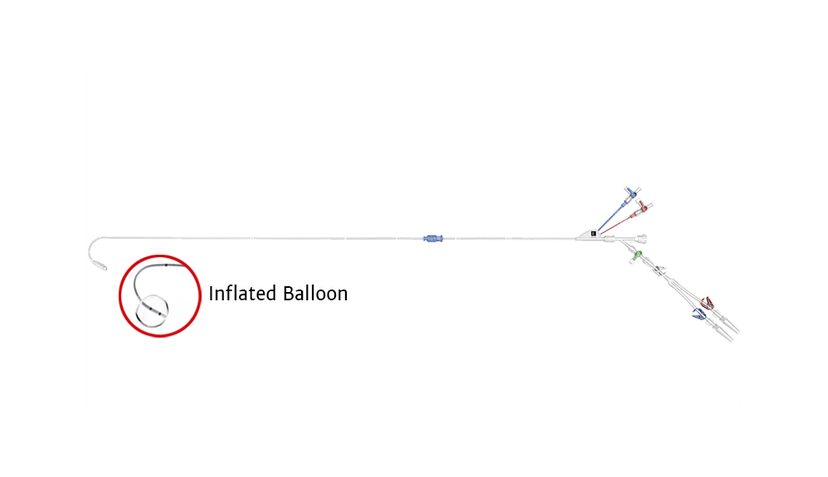 IntraClude Device | Edwards Lifesciences