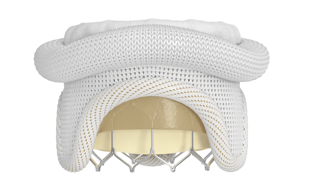 SAPIEN 3 valve in surgical mitral bioprosthetic valve