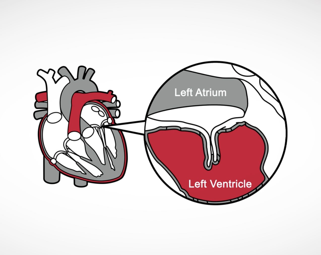 Left Atrium Left Ventricle