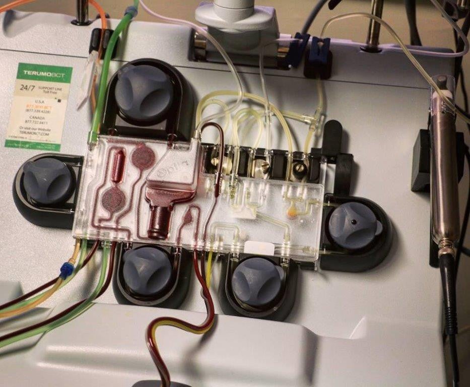 Apheresis Machine | Sharing America’s Marrow