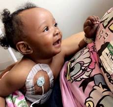 DKMS patient True with her central line smiling