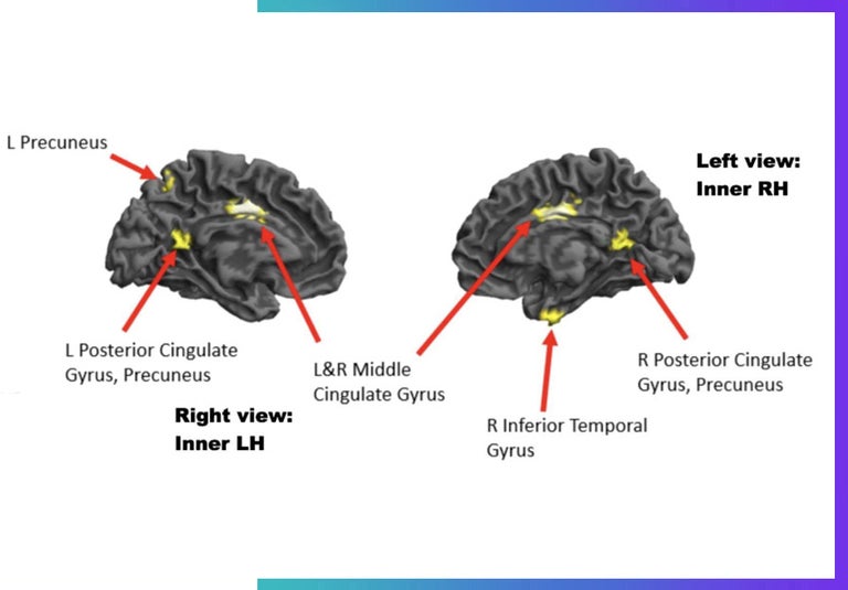 Drexel University brain imaging of the Flow State. 