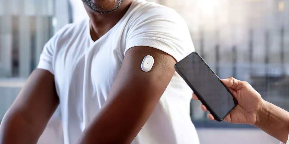 Continuous Glucose Monitoring