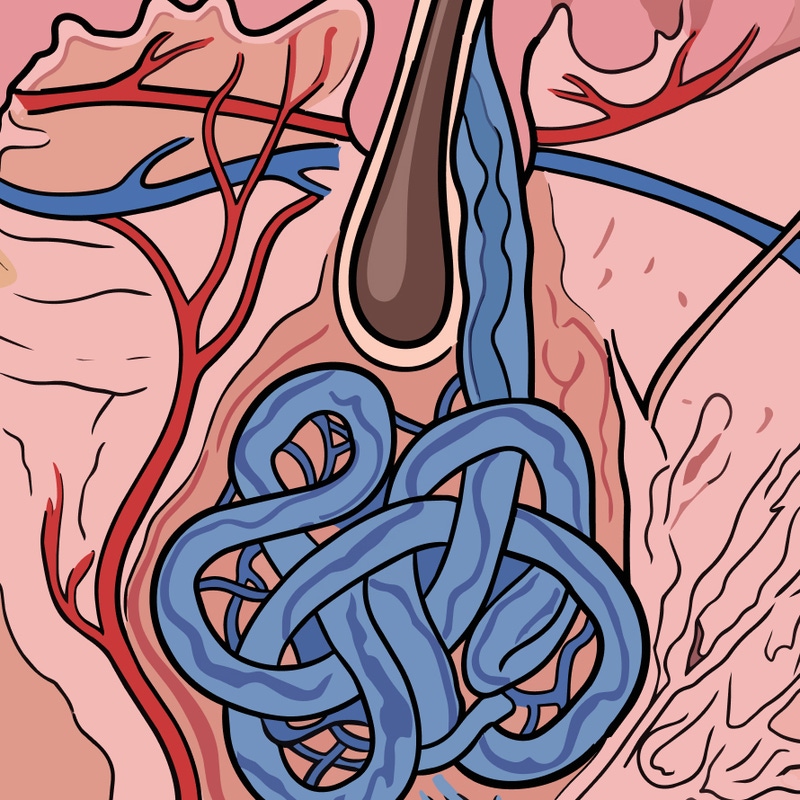 Apoeccrine