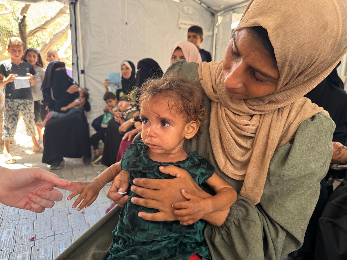A mother holds her severely malnourished young daughter.