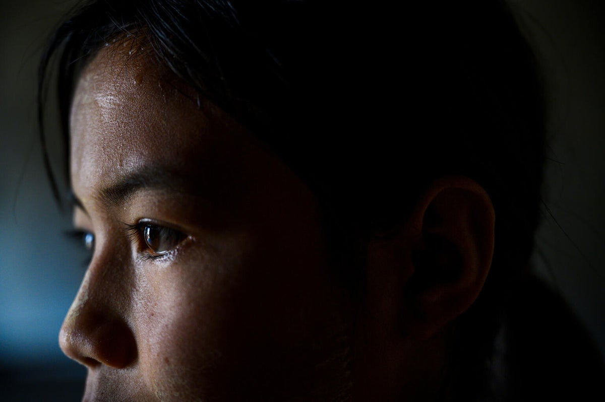 Naw Nee, a 14-year-old from the Bago region, bears the lasting scars of a tragic landmine explosion. 