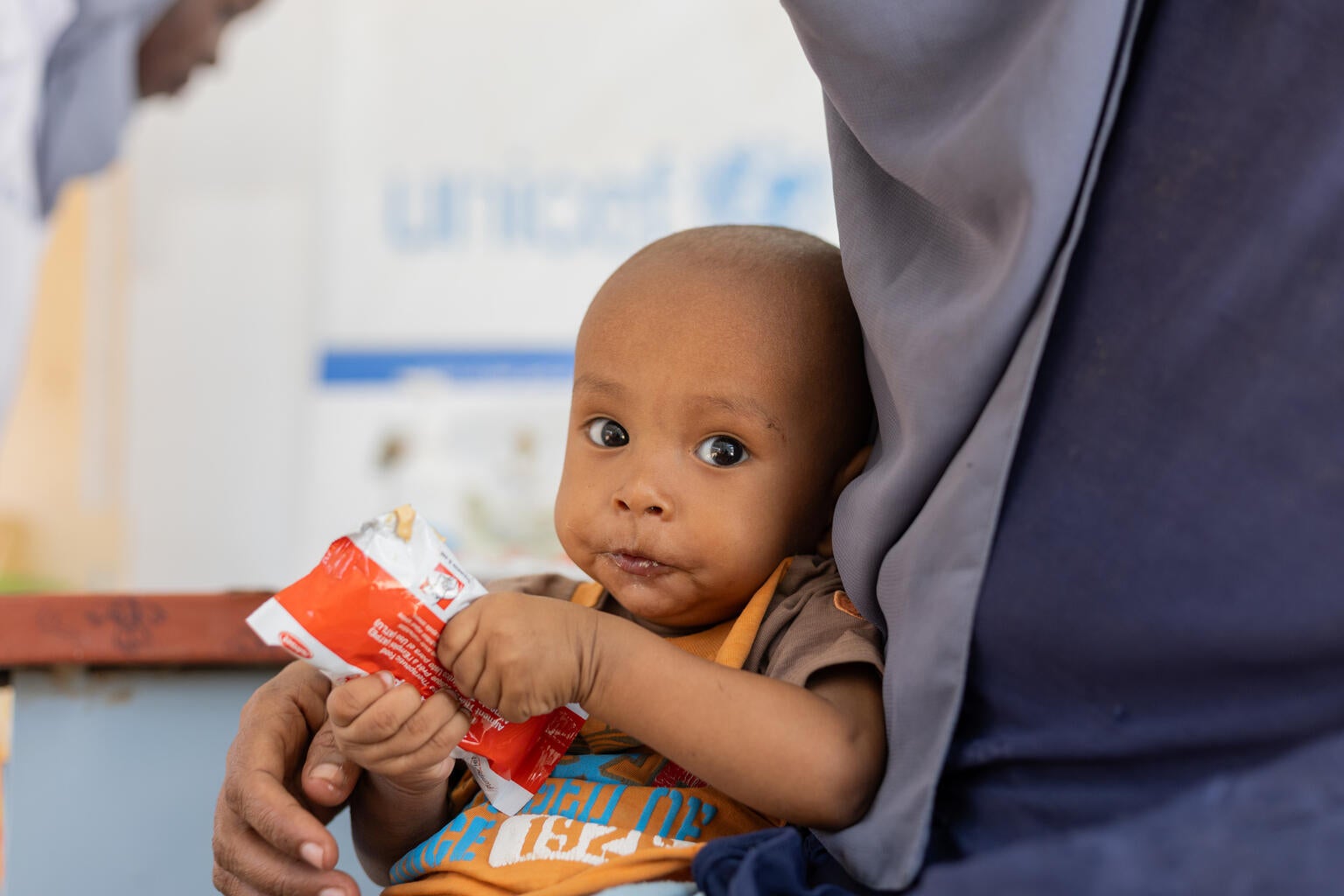 A baby girl receives treatment in Sudan for malnutrition.