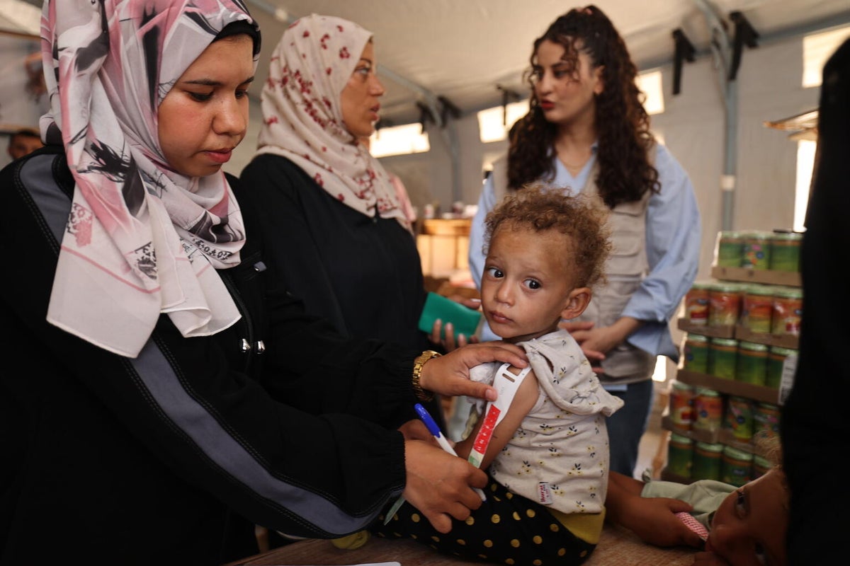 A one-year-old baby started losing weight because it was difficult for her family to find food. She started to improve slightly when she began eating the nutrition supplements provided by UNICEF. 