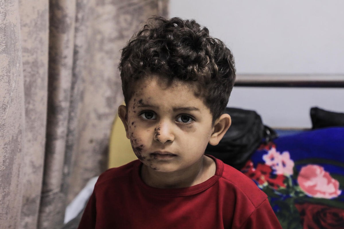 Three-year-old Yehya was injured during an airstrike in September 2025 that killed his eldest brother, Moaz, and left his 10-year-old sister, Nour, with devastating injuries.