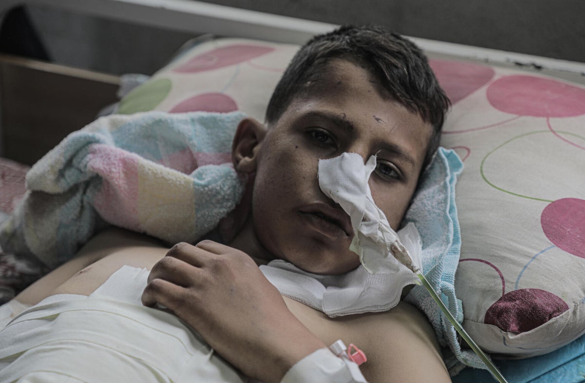 A young boy being treated for injuries after an airstrike on a school turned shelter in Gaza.