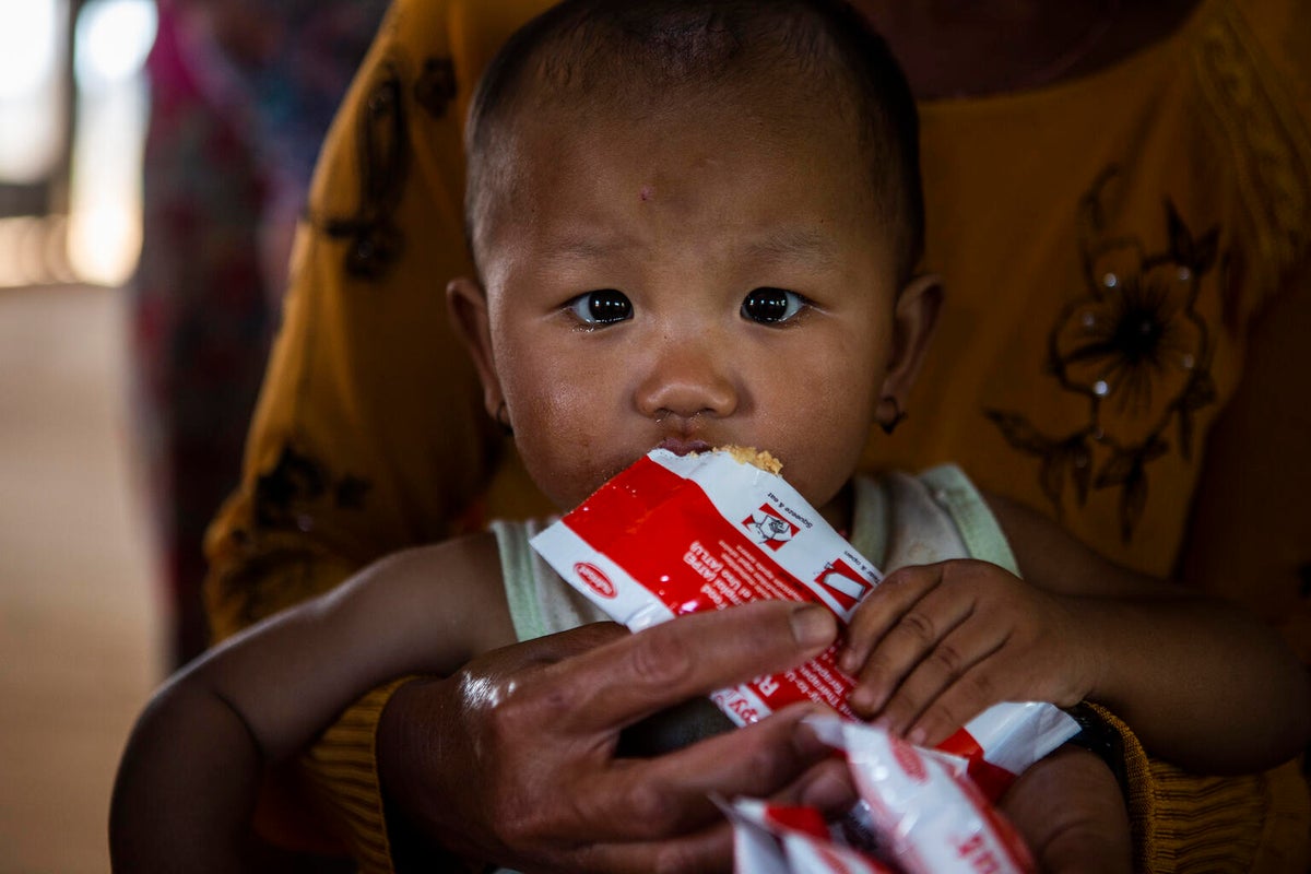One-year-old Nan eats ready-to-use therapeutic food at a displacement camp in northeastern Myanmar.