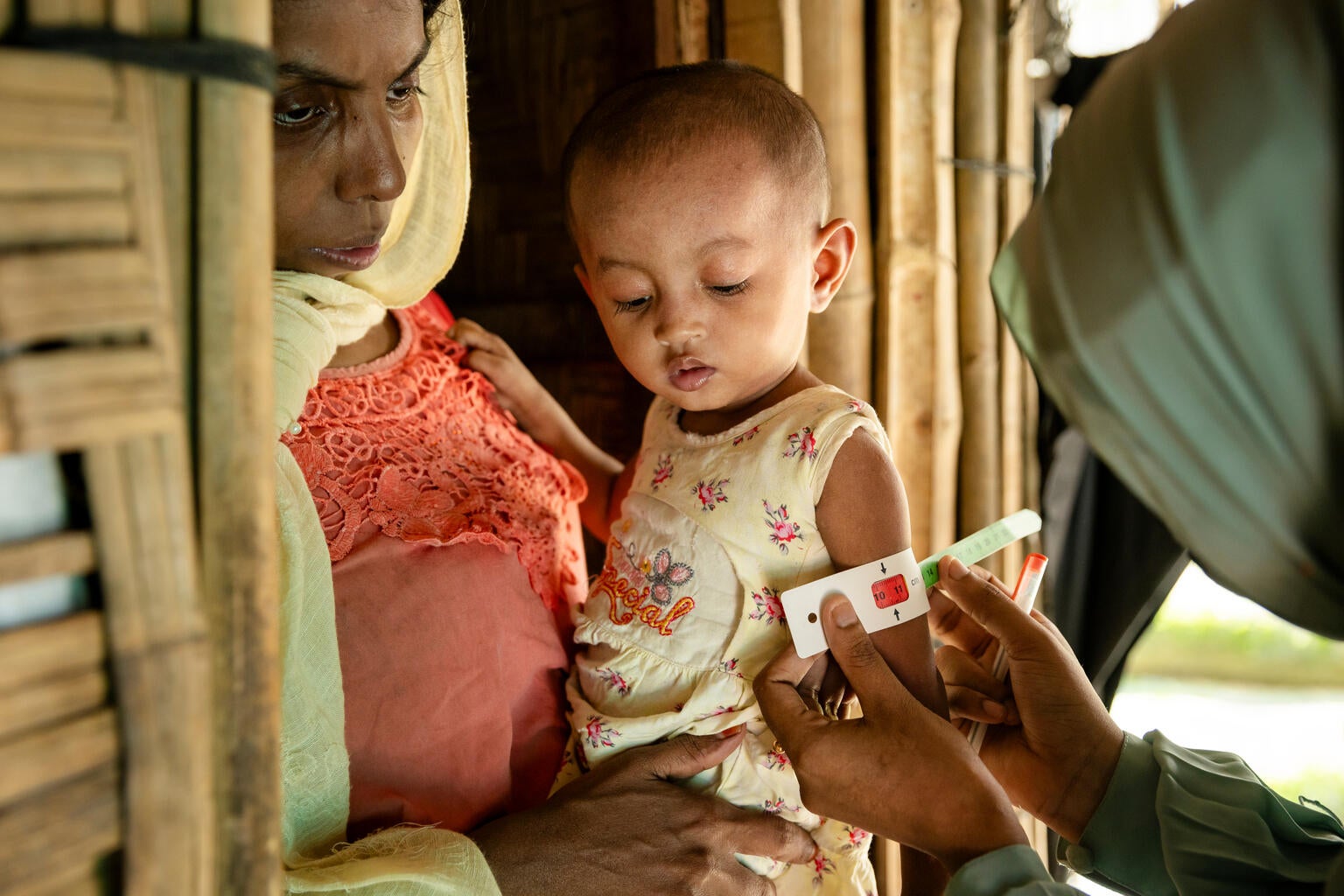 A young girl being tested for SAM (severe-acute-malnutrition). 