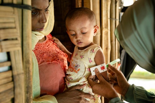 A young girl being tested for SAM (severe-acute-malnutrition). 