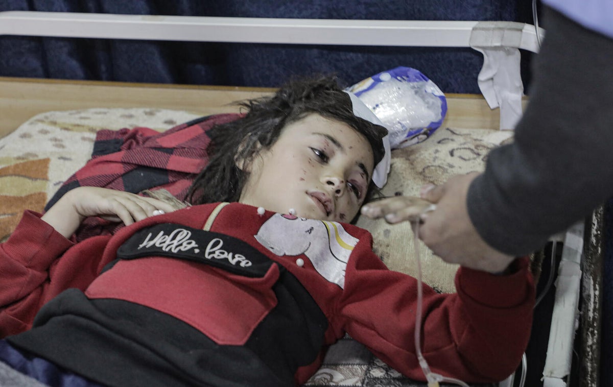 A young girl being treated for injuries after an airstrike on a school turned shelter in Gaza.