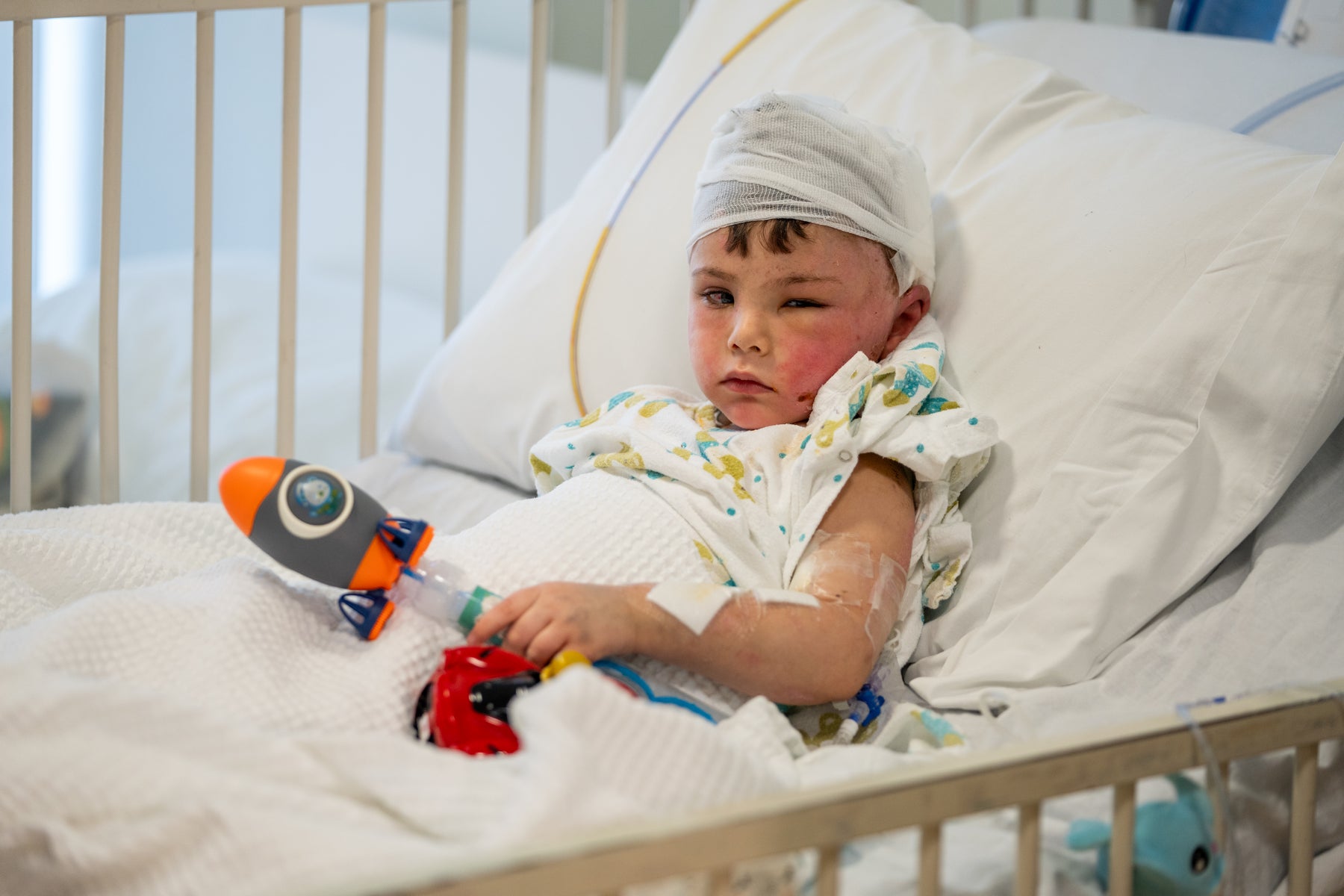 Two-year-old Ali, who lost his entire family in an airstrike, sits in a hospital bed in Lebanon.
