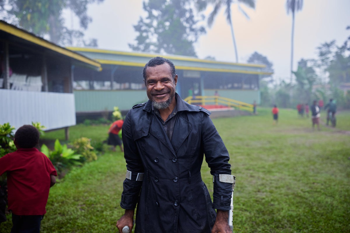 An early learning teacher at the UNICEF-supported Early Learning Centre, has been trained in inclusive education. 