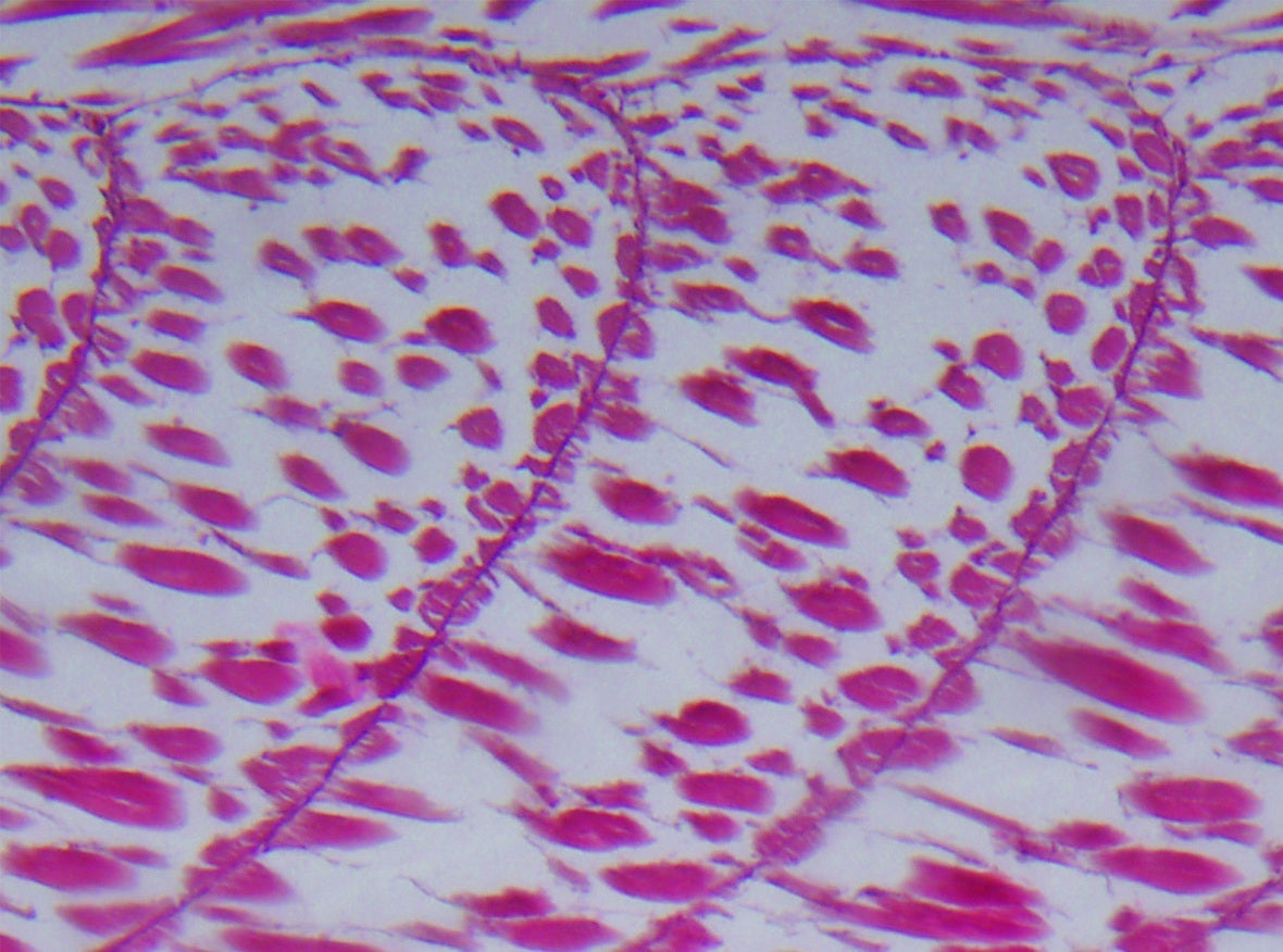 Alternative protein under a microscope 