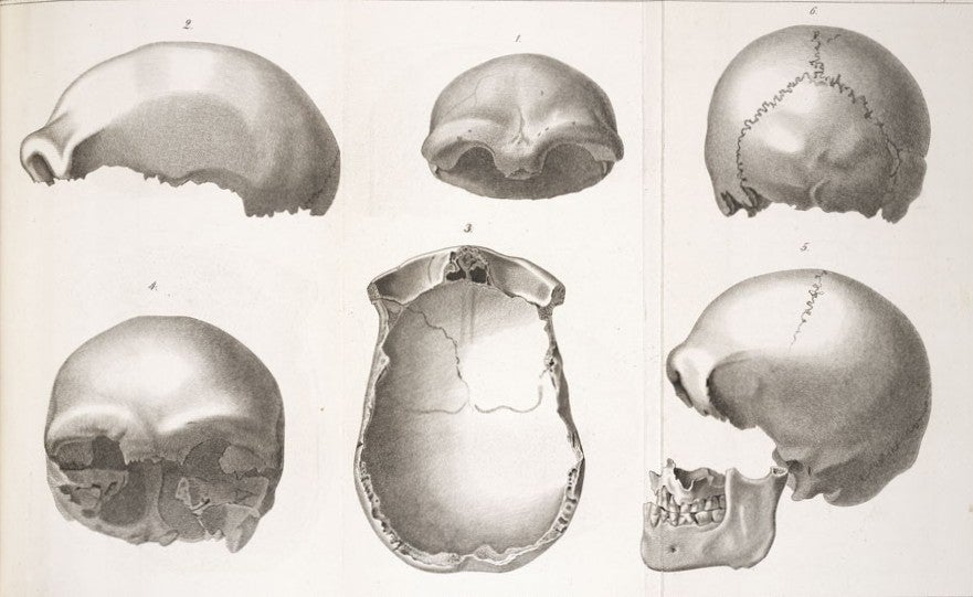 Neanderthal man skull cap. Image source: Schaafhausen, Hermann. "Zur Kenntniss der altesten Rassenschädel.” Archiv fur Anatomie, Physiologie und Wissenschaftliche Medicin, vol. 25, 1858, pl. 17. 