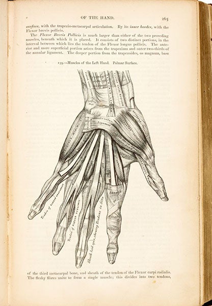 Wood engraving of a dissected human hand, by Henry Vandyke Carter, in Anatomy, Descriptive and Surgical, by Henry Gray and Henry Vandyke Carter, fig. 159, p. 265, first edition of 1858, copy at auction by Sotheby’s, 2020 (sothebys.com)